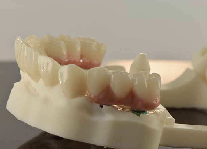 CLÍNICA MG IMPLANTES DENTALES