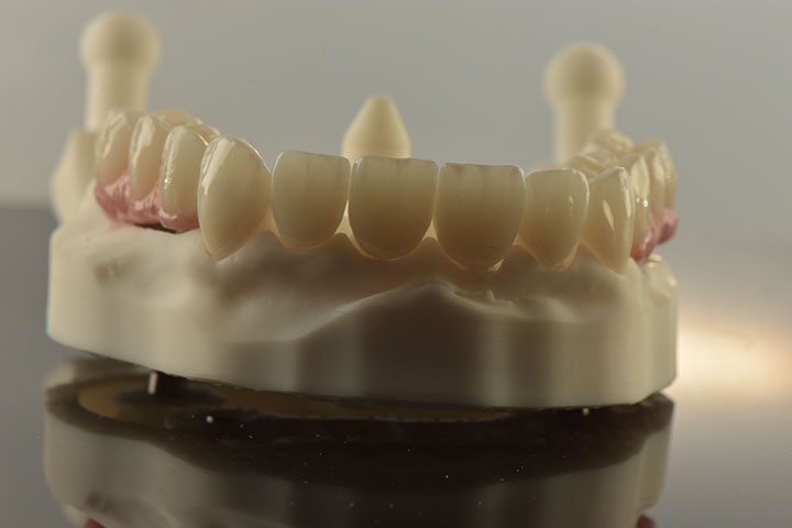 CLÍNICA MG IMPLANTES DENTALES