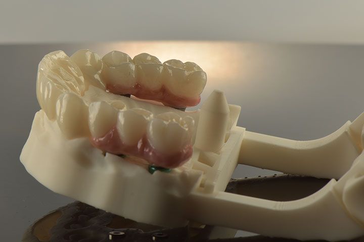 CLÍNICA MG IMPLANTES DENTALES