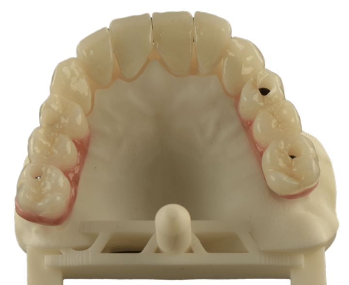 CLÍNICA MG IMPLANTES DENTALES