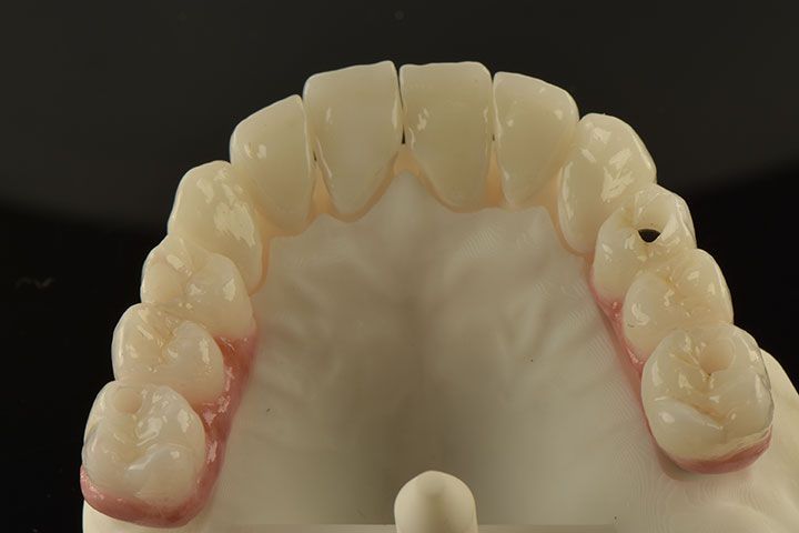 CLÍNICA MG IMPLANTES DENTALES
