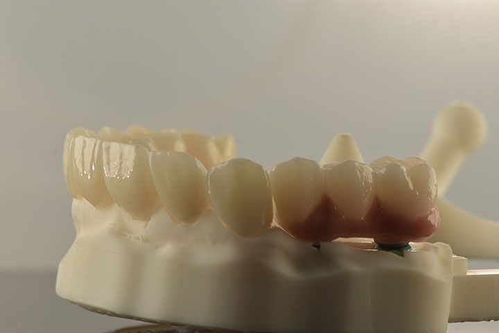CLÍNICA MG IMPLANTES DENTALES