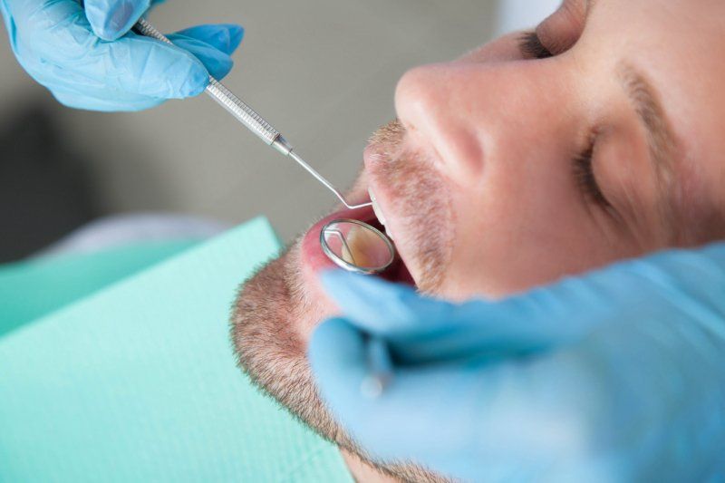 protesi dentale parziale