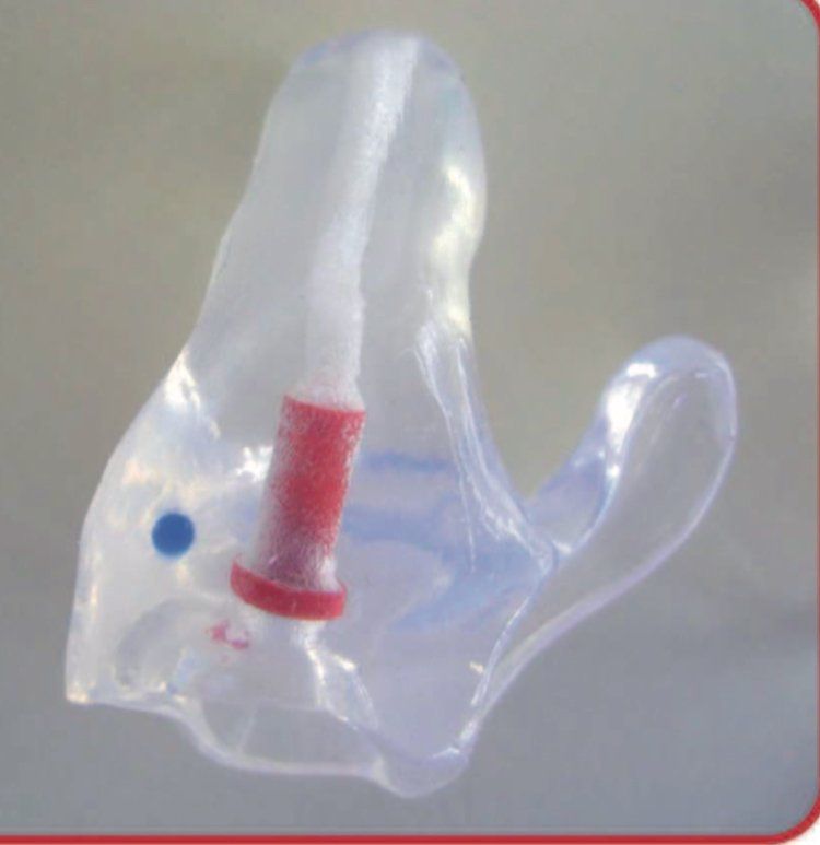 tappo auricolare personalizzato