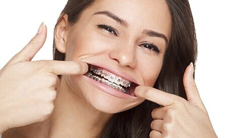 Smile with Braces — Braces in Banning, CA