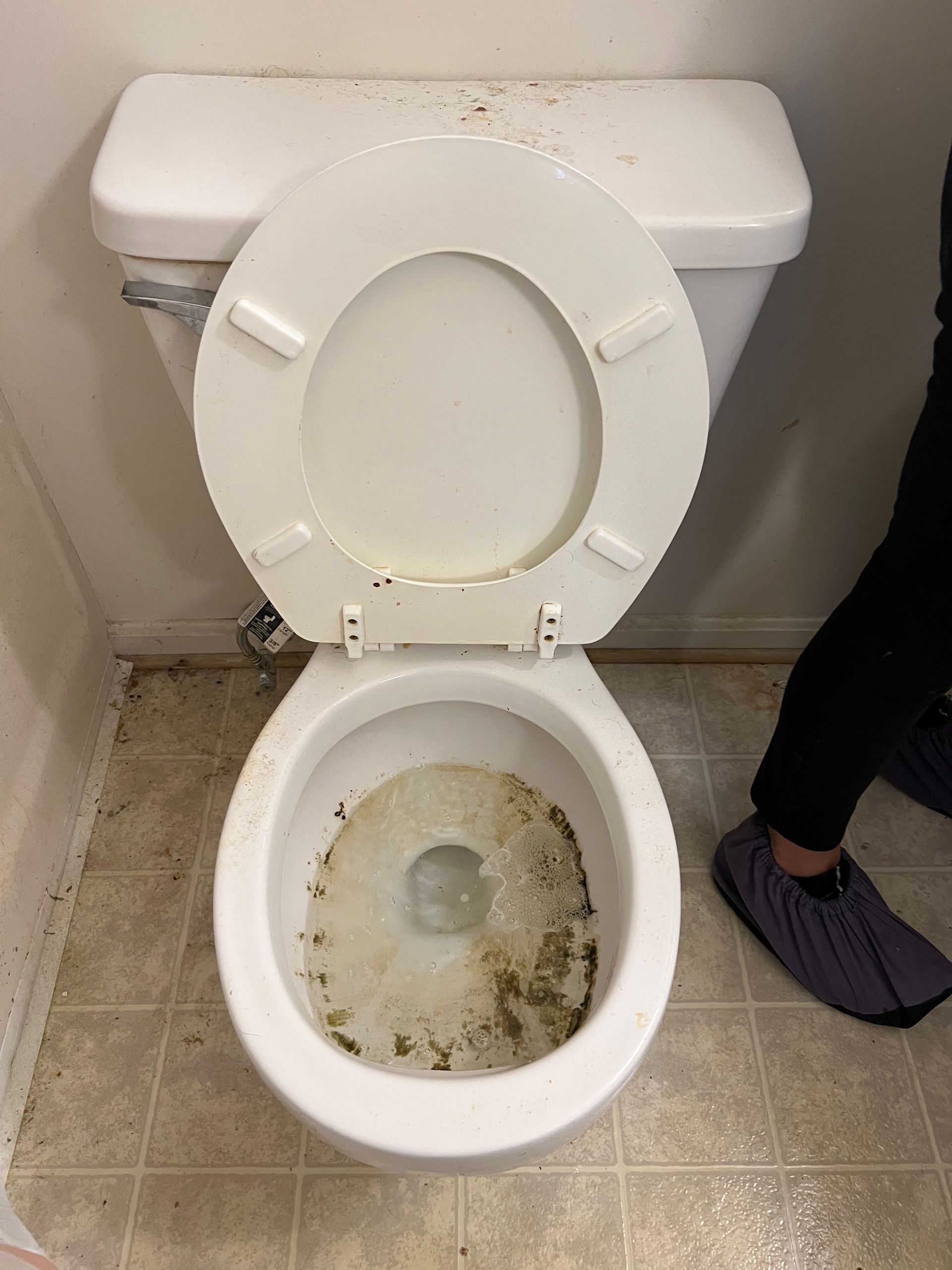 a dirty toilet in a bathroom with a person standing next to it .