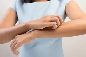 Skin Desease