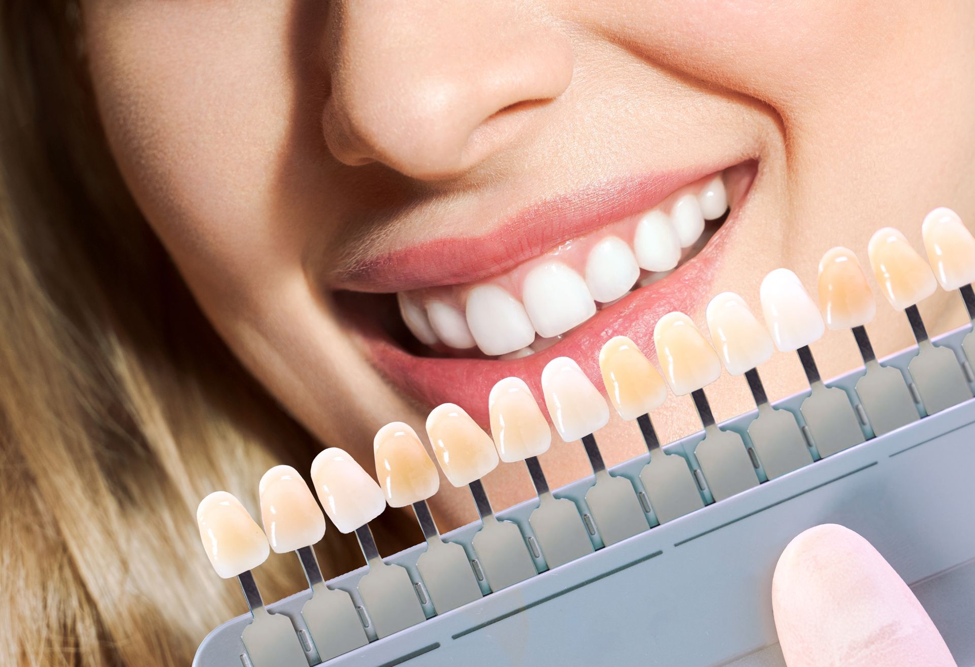 Woman smiling, holding teeth shade guide next to her white teeth.