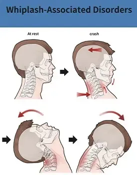 neck-conditions-treated-with-chiropractic-care-round-rock-tx