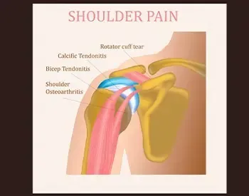 shoulder-injuries-treated-with-chiropractic-care-leander-tx