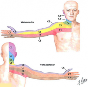 Cervicobraquialgia