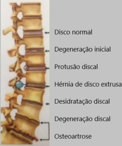 Coluna com evolução do desgaste dos discos (1)