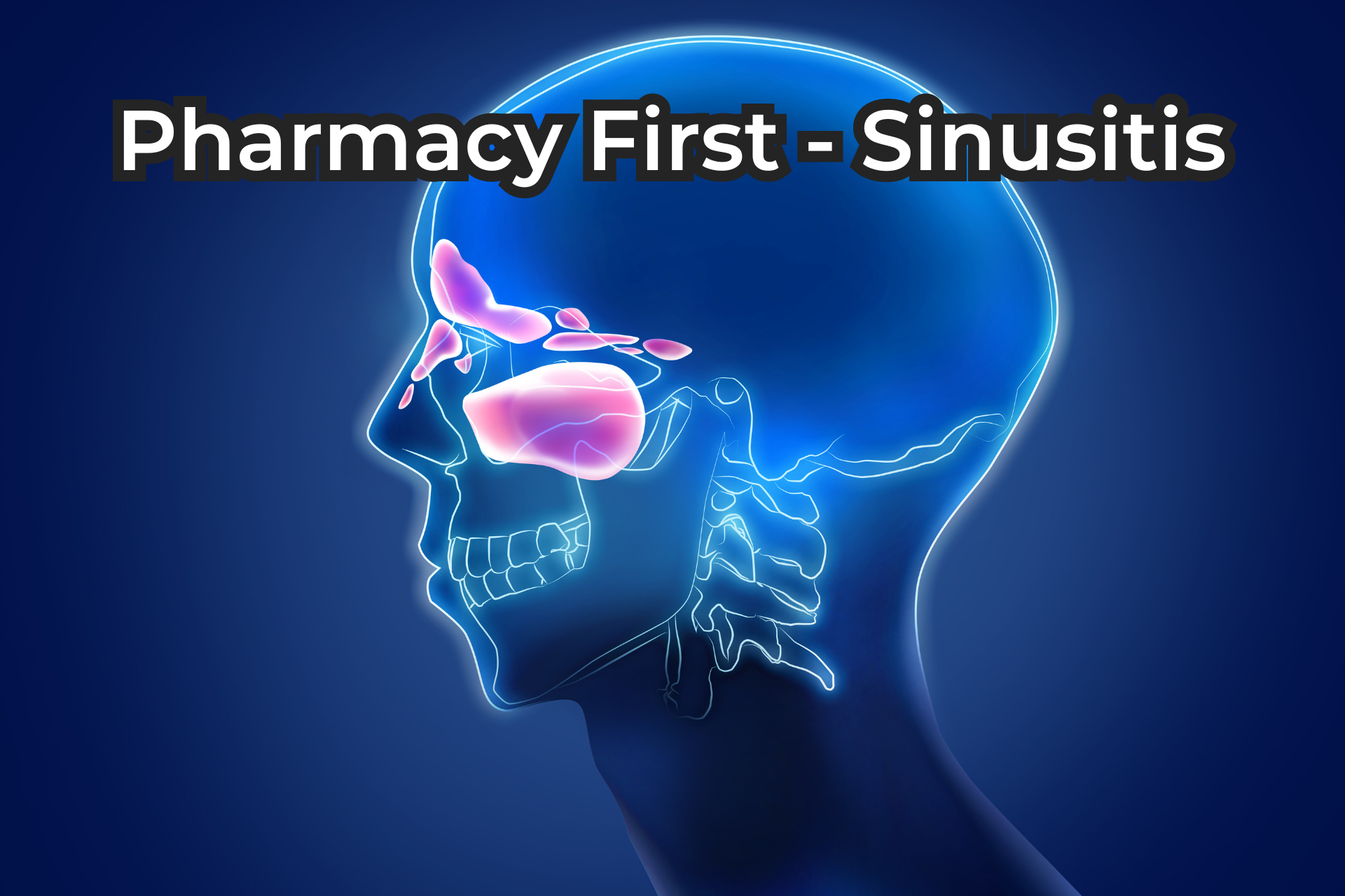 Sinusitis Treatment Letchworth - Pharmacy First