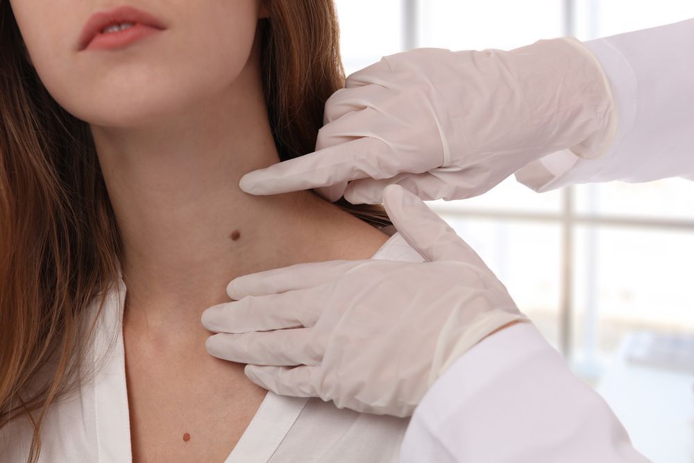 Doctor examining a mole on a woman's neck. Doctor in gloves points to the mole.