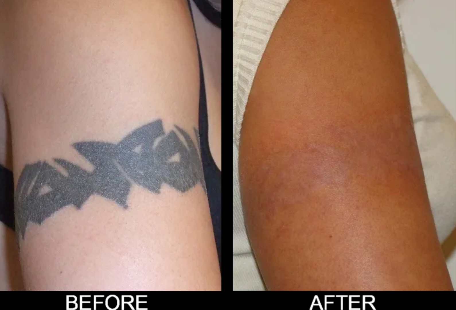 A before and after picture of a tattoo on a woman 's arm