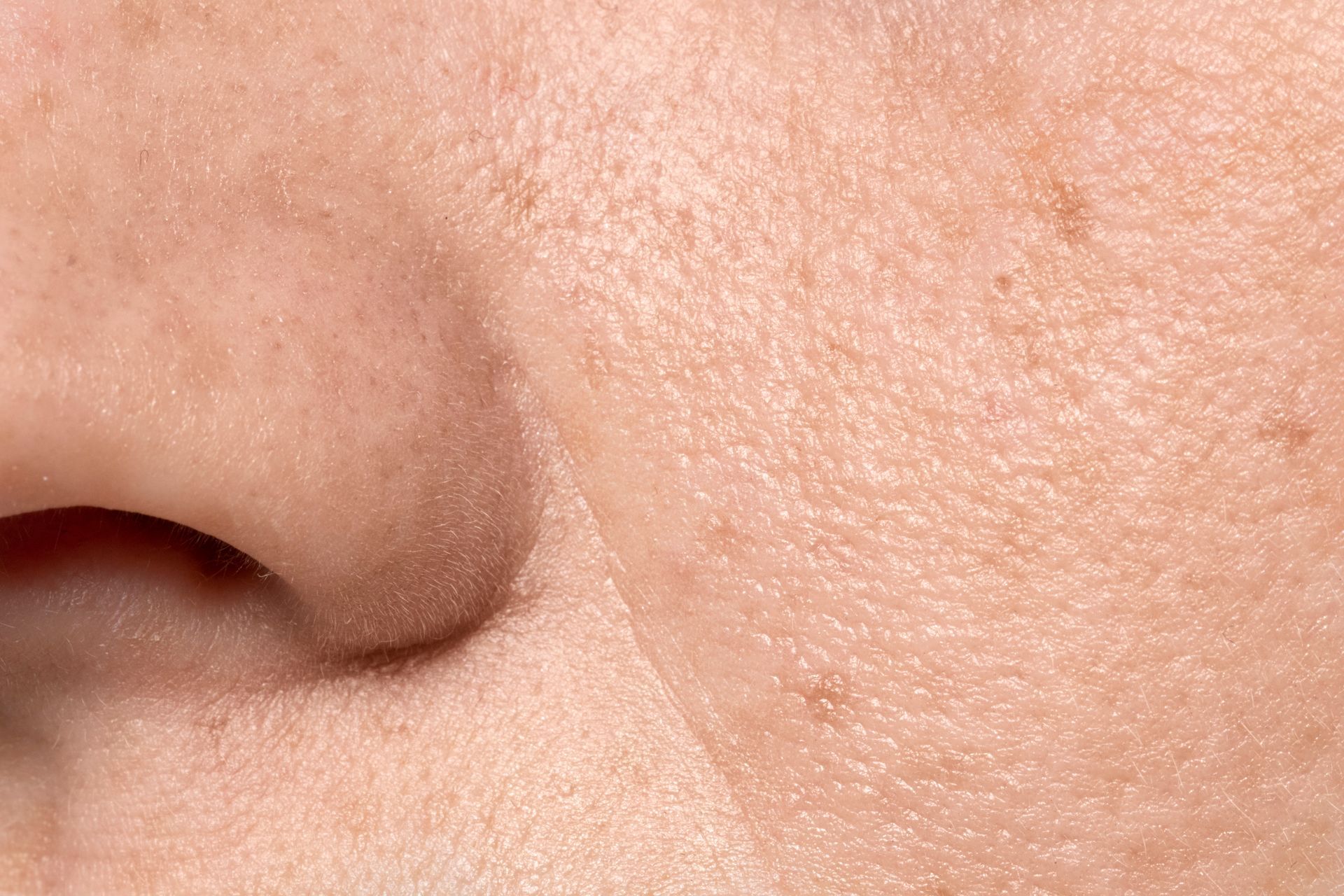 Close-up of a nose and surrounding facial skin, showing pores and minor discoloration.