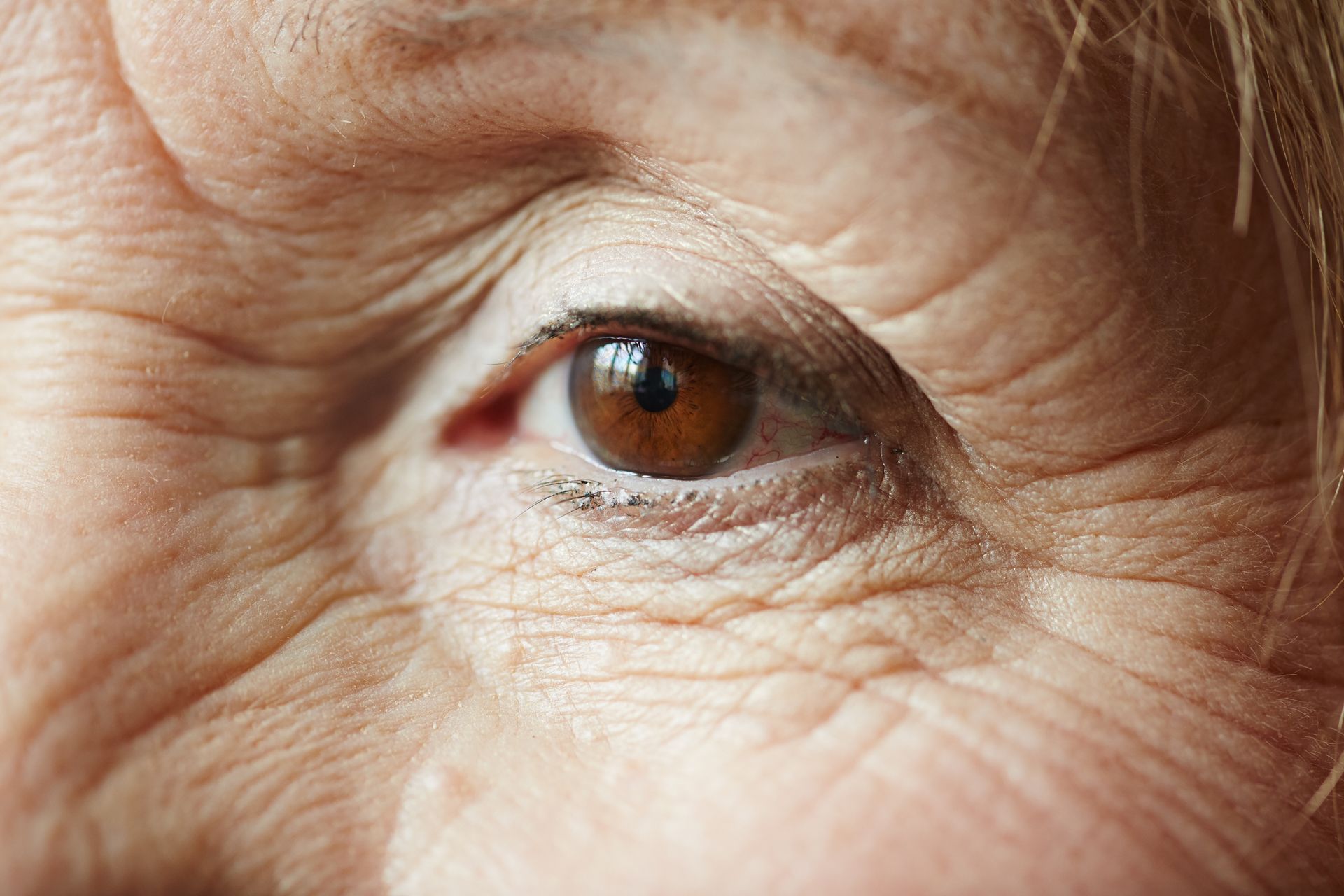 Close-up of a brown eye with visible wrinkles around the eye.