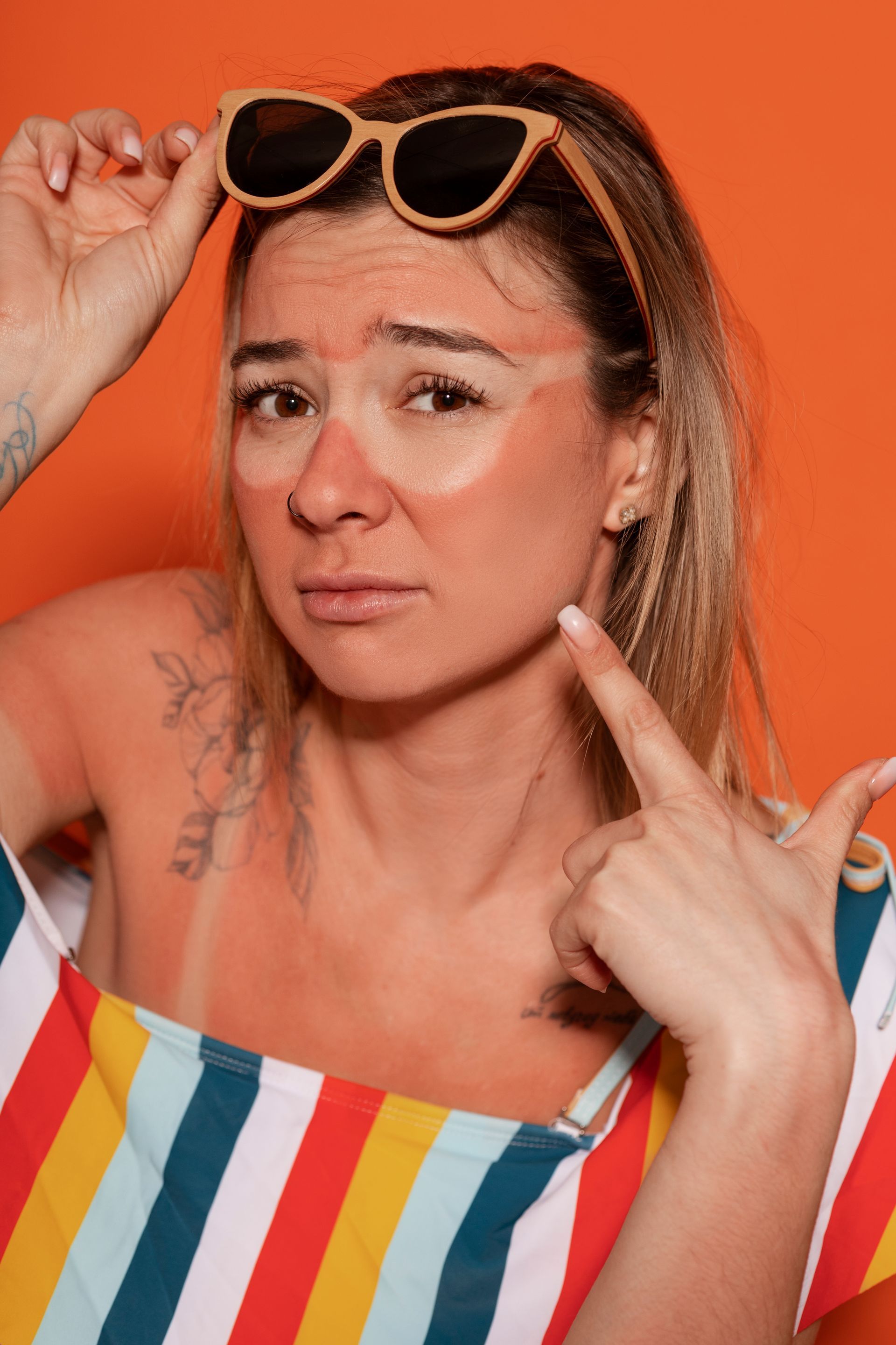 Woman with sunglasses on head, sunburned skin, pointing at face, wearing a striped top, orange background.