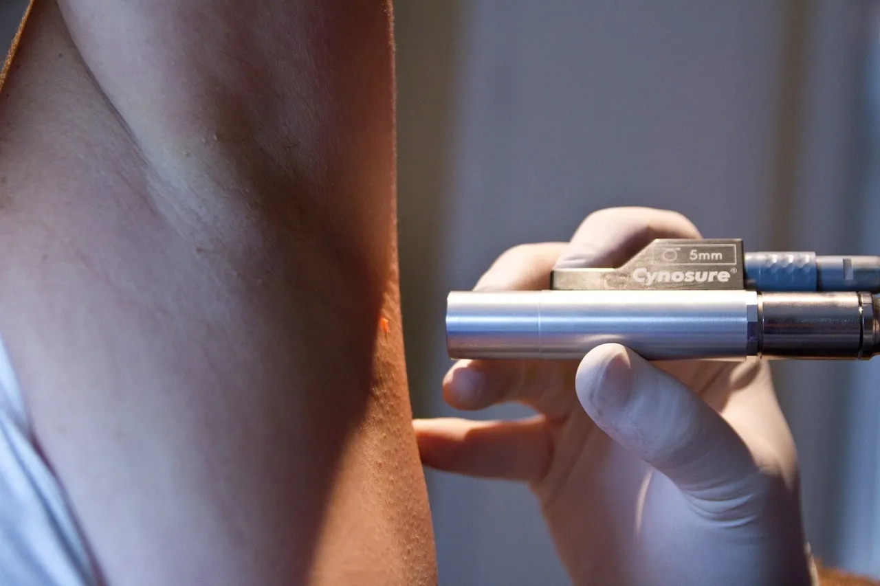a woman getting skin tag removal