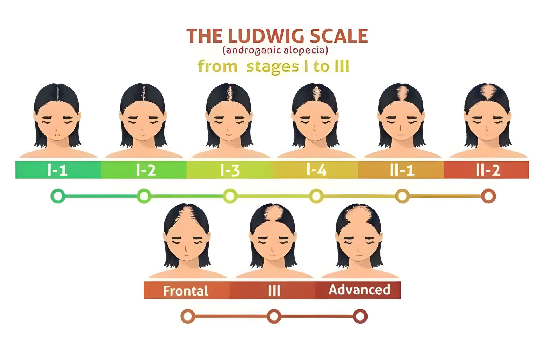 A picture of the Ludwig scale