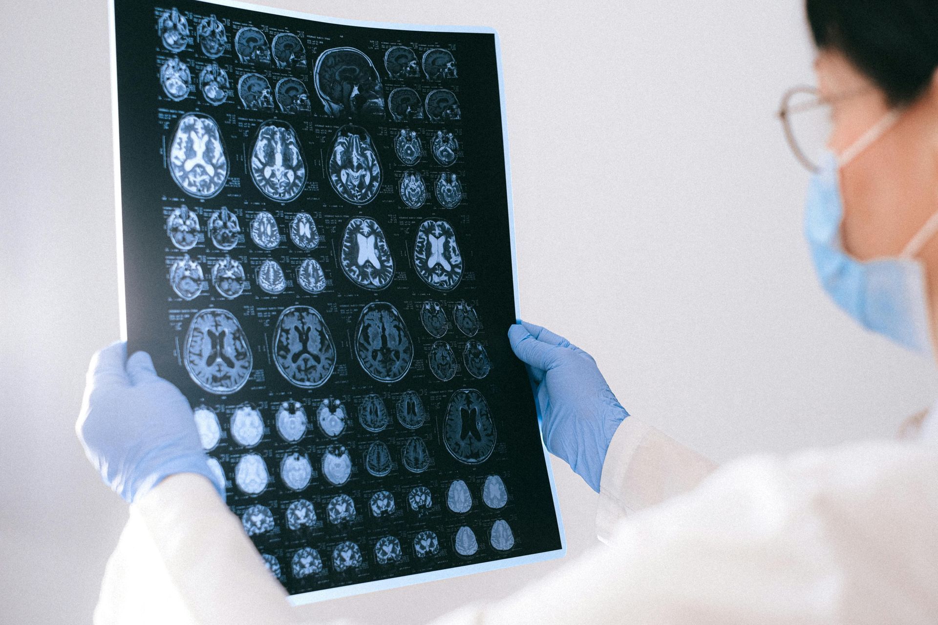 A doctor wearing a mask and gloves is holding a x-ray of a brain.