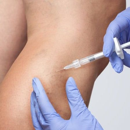 Skjerosering i Kristiansand