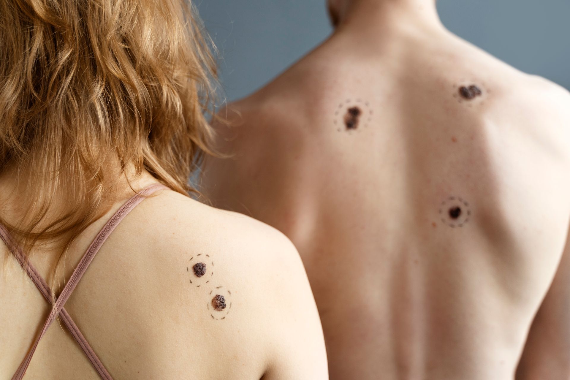 Two people's backs, each with dark circular marks. The woman wears a pink top. Gray background.