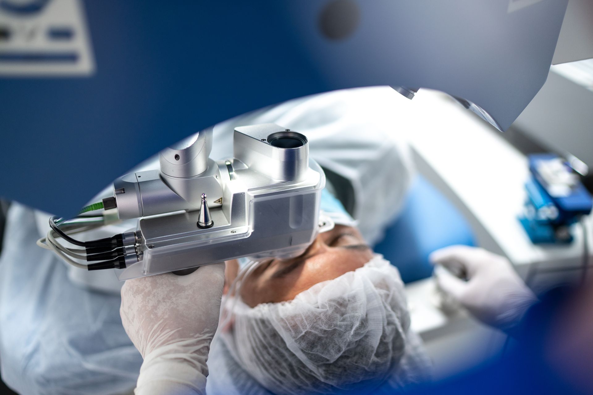 Laser eye surgery: Patient's eye under laser device in a sterile operating room setting.
