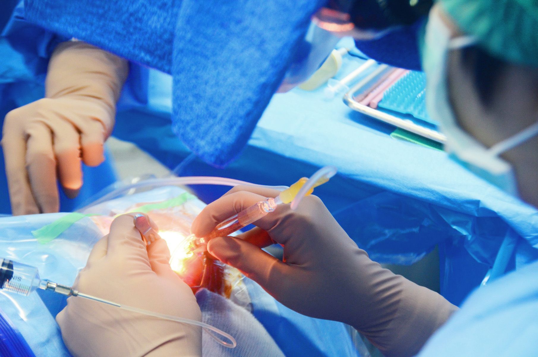 Surgeons in blue scrubs perform an operation. Sterile equipment surrounds the patient.
