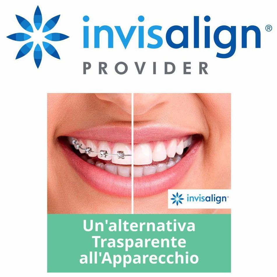invisalign 3