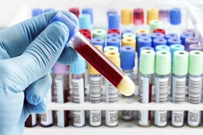 LABORATORIO SAN ÁNGEL