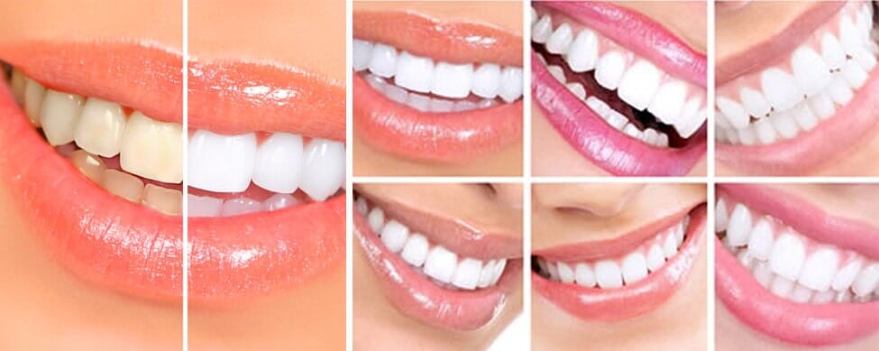 Dra. Jocelyn Vargas Somarriba sonrisas