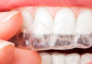 Dra. Jocelyn Vargas Somarriba persona con brackets invisibles