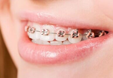 Dra. Jocelyn Vargas Somarriba persona con brackets