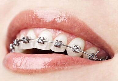 Dra. Jocelyn Vargas Somarriba persona con ortodoncia