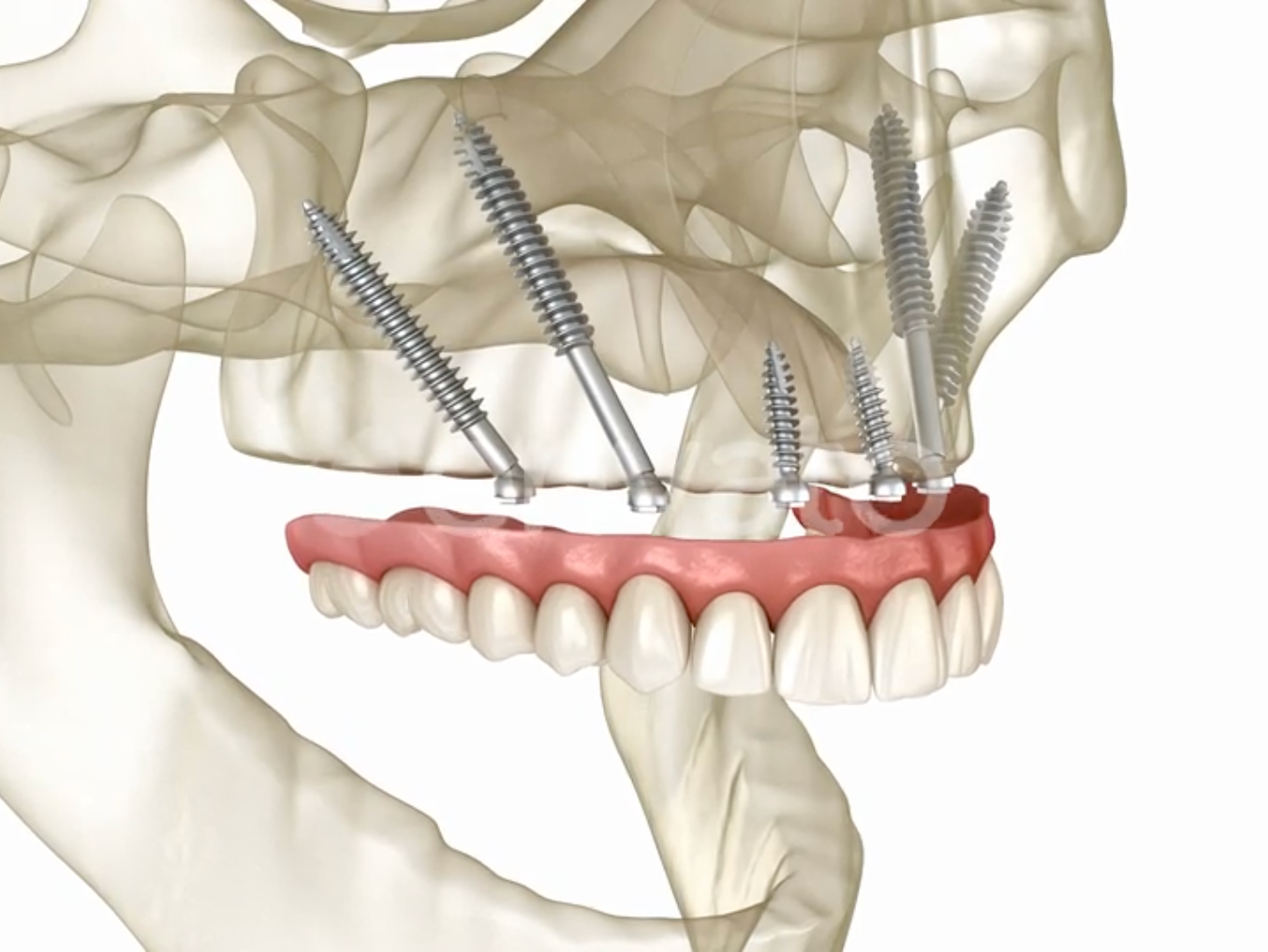 woman-viewing-teeth