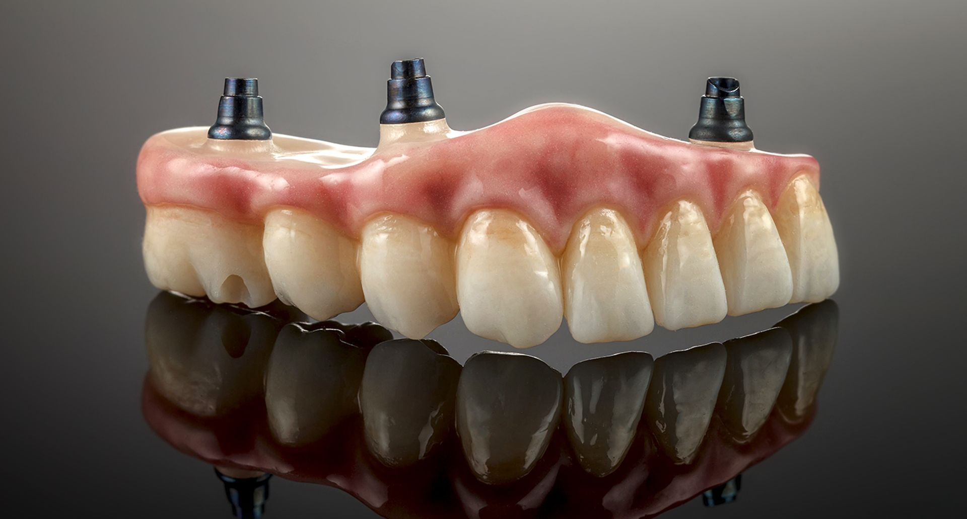 Dental implant-supported upper prosthetic teeth with pink gum base on a reflective black surface