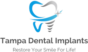 tampa dental implants