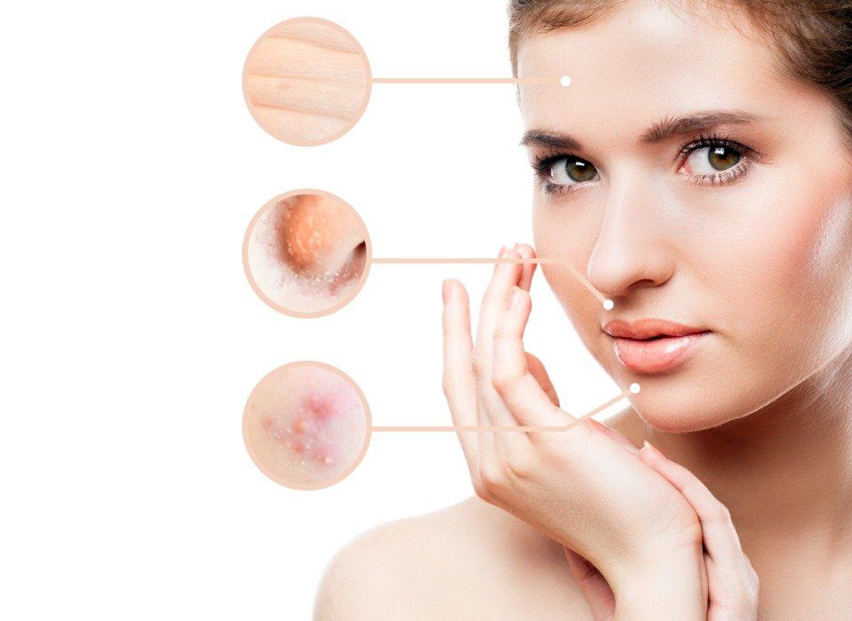 trattamento inestetismi viso