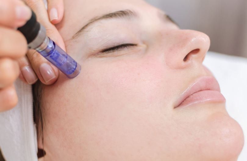 microneedling brighton