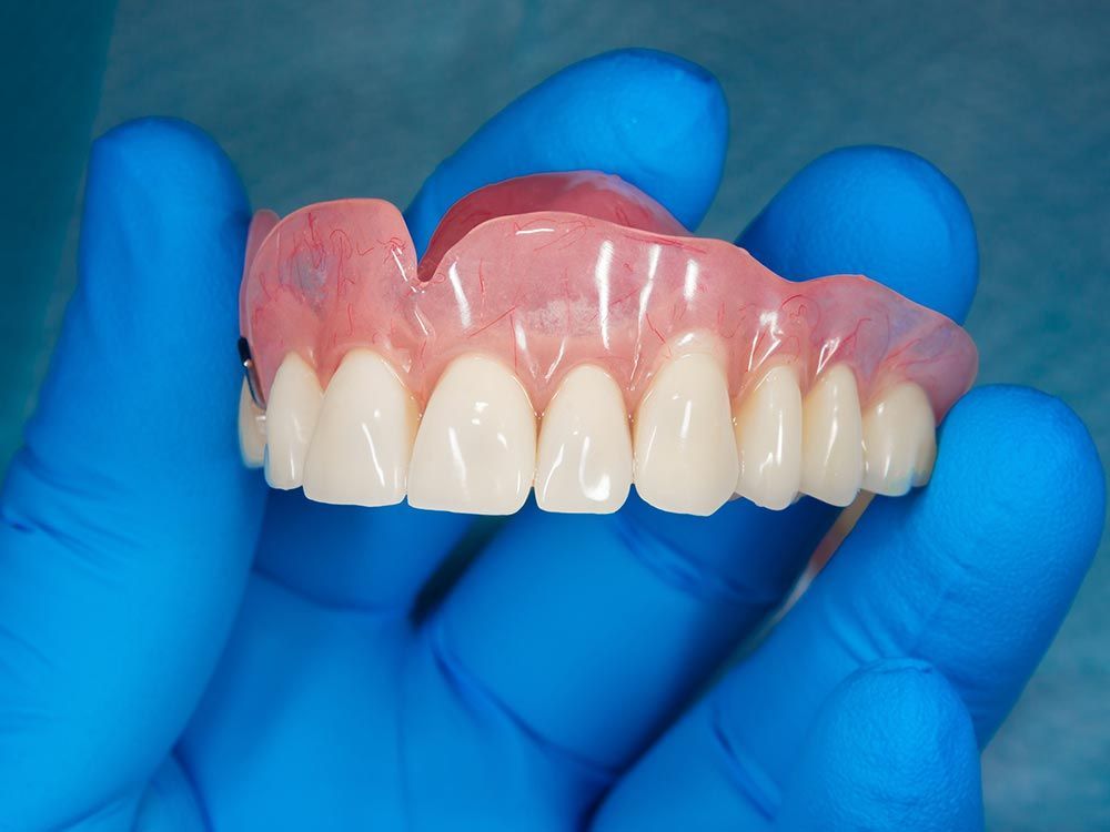 A blue-gloved individual displays a dental implant, highlighting custom dentures offered by Laney De