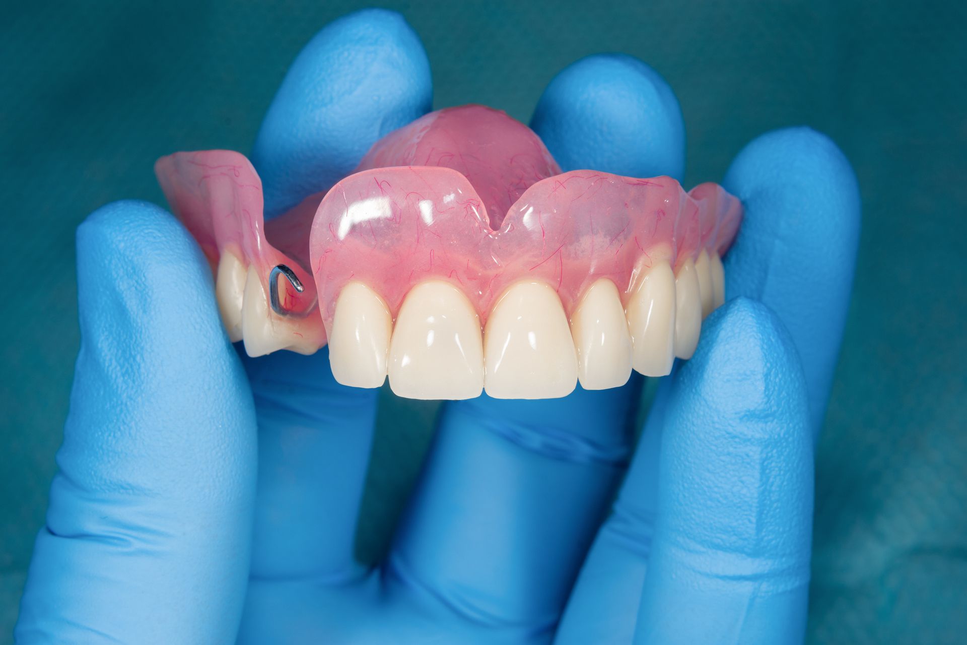 Dentist holding dentures, offering custom denture solutions for a perfect fit and natural smile.