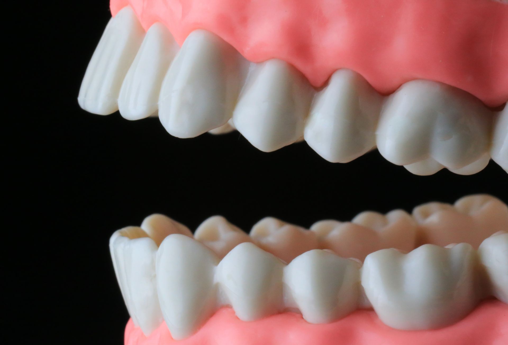 Model of teeth, showing upper and lower rows. White teeth set in pink gums, with a black background.