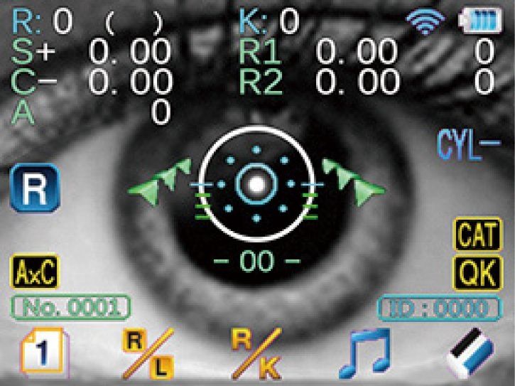 dati forniti da misuratore della vista