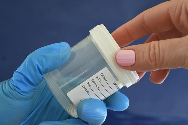 Close-up of medical personnel handing a patient a urine specimen cup for a sample to be tested.
