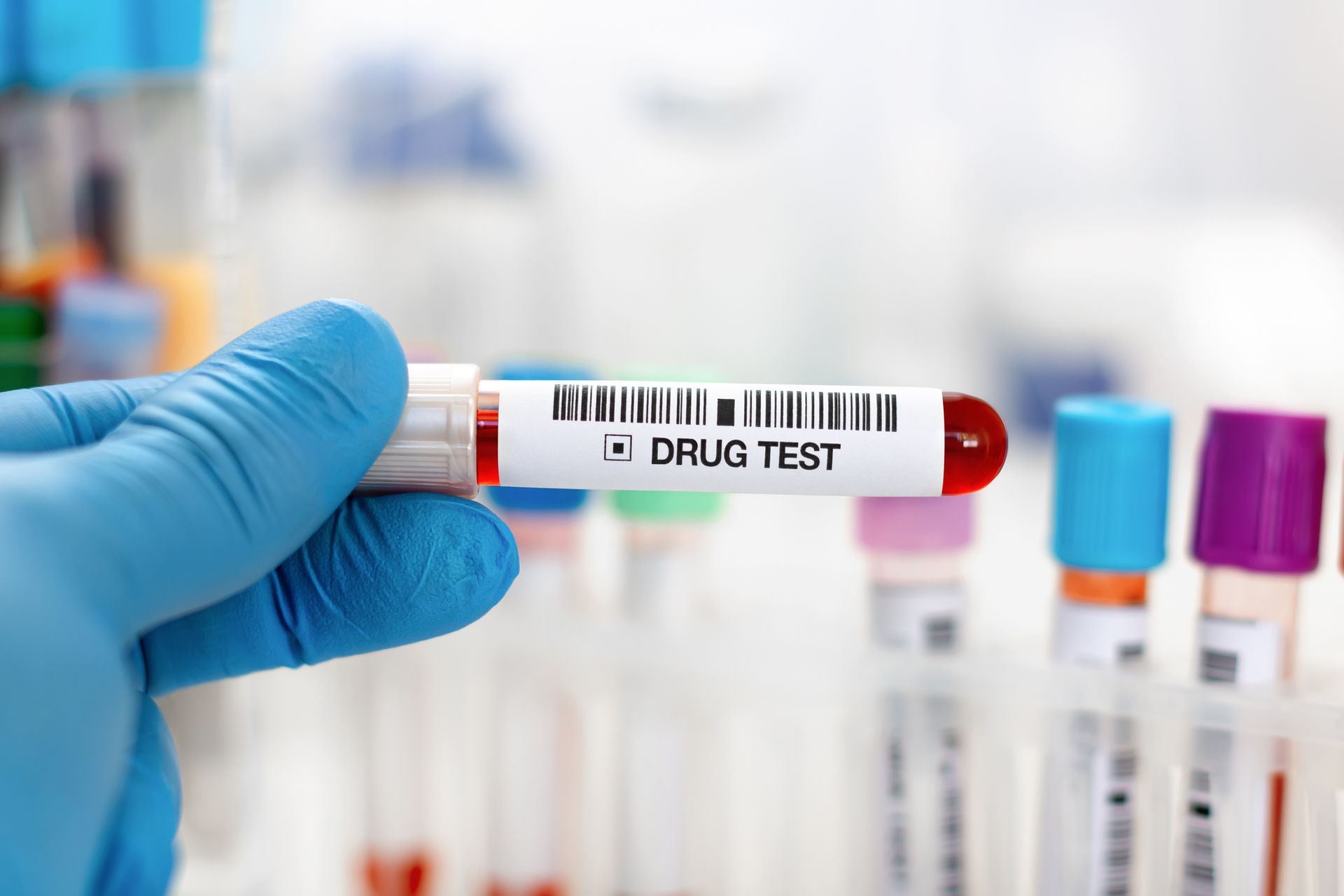 Doctor's hand holding urine and blood samples for instant drug screening at Salisbury Medical Centre