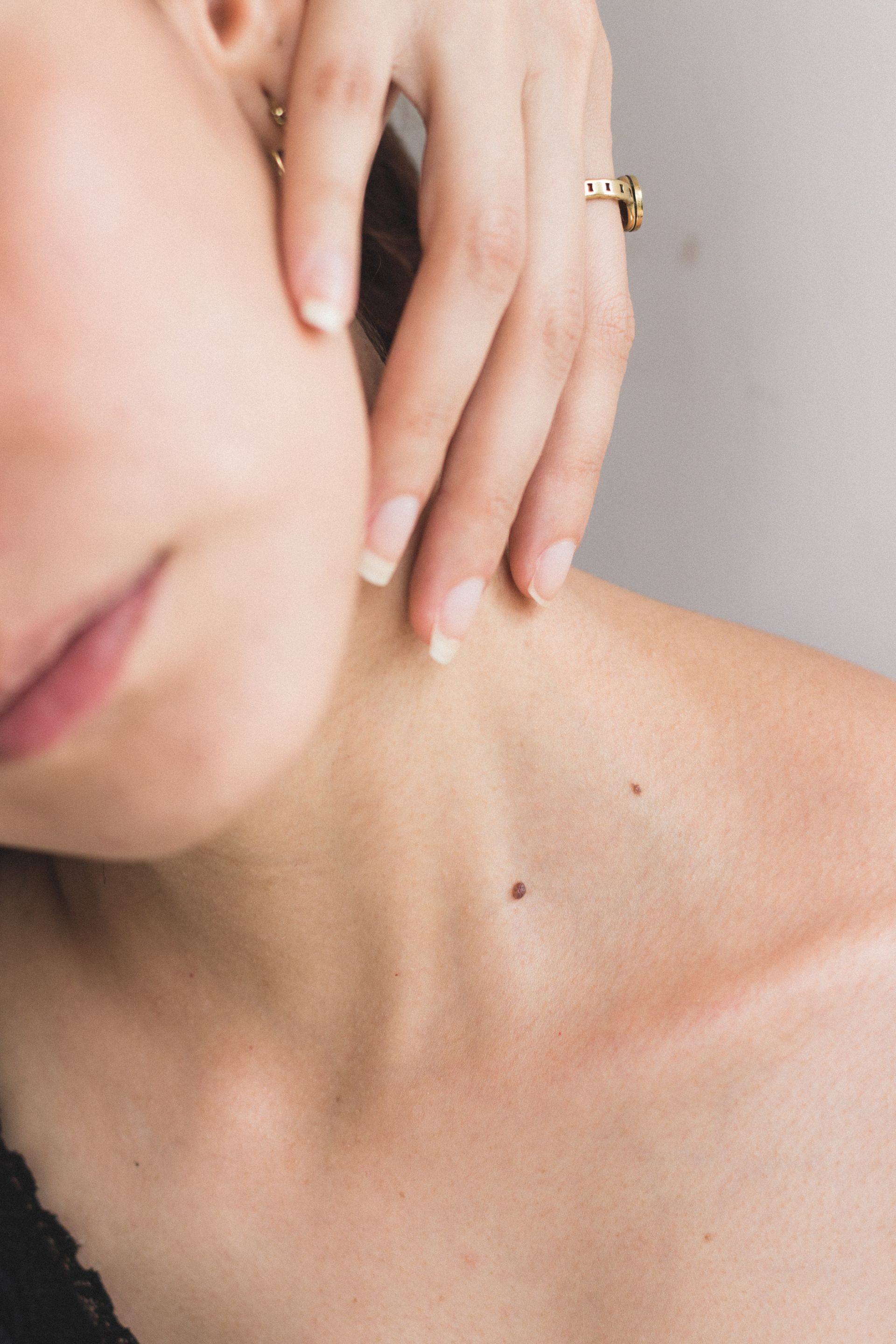 Speak to your doctor about having a skin check