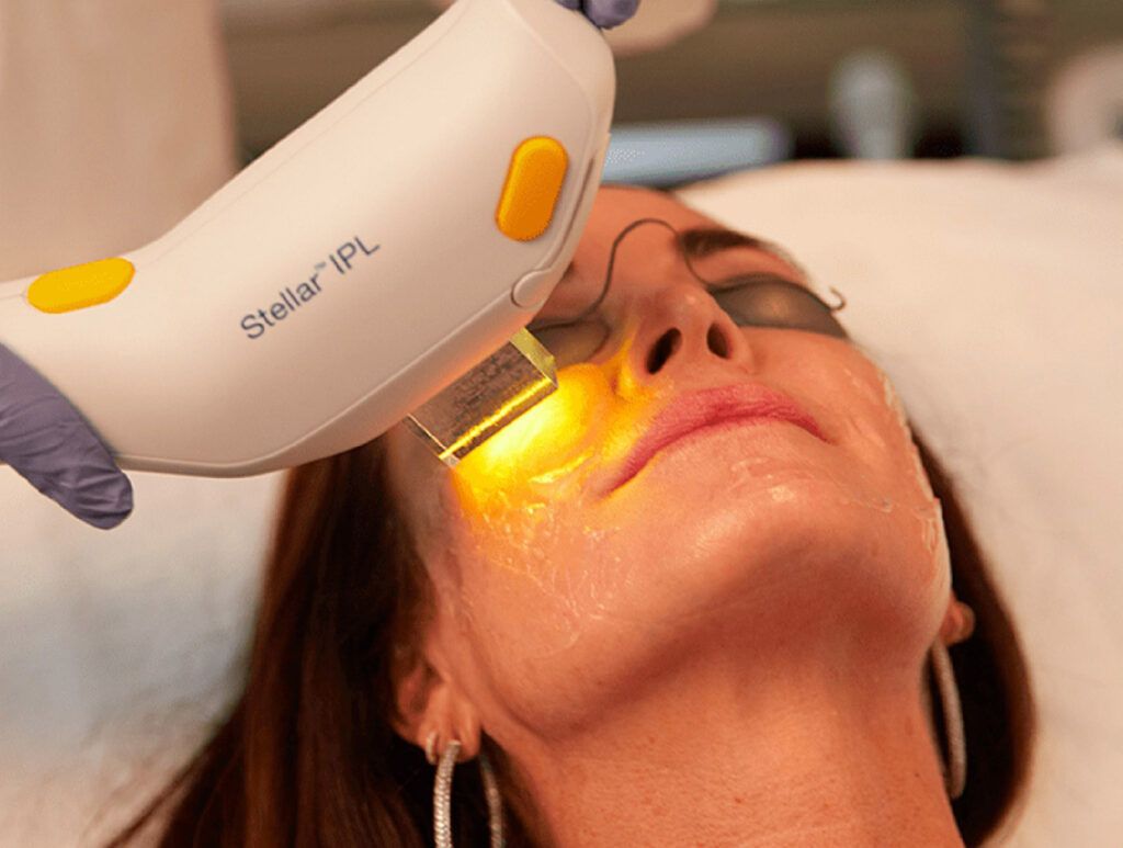 A woman is getting an ipl treatment on her face