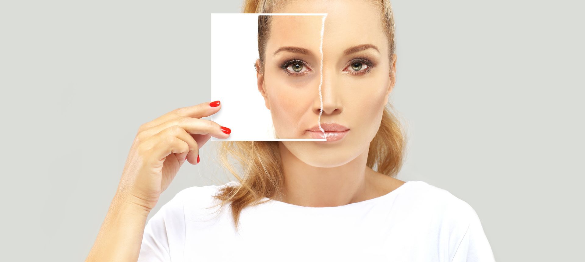 Nasolabialfalten Unterspritzung