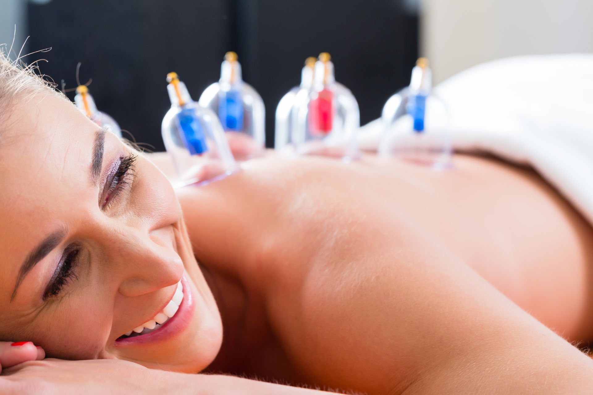 Frau Schröpfen Rücken